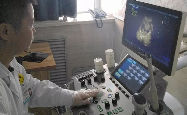 医生用M50为10周大小的胎儿进行检查