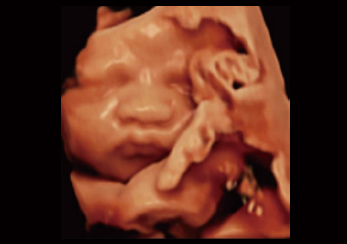 胎儿脸部高清梯度渲染
